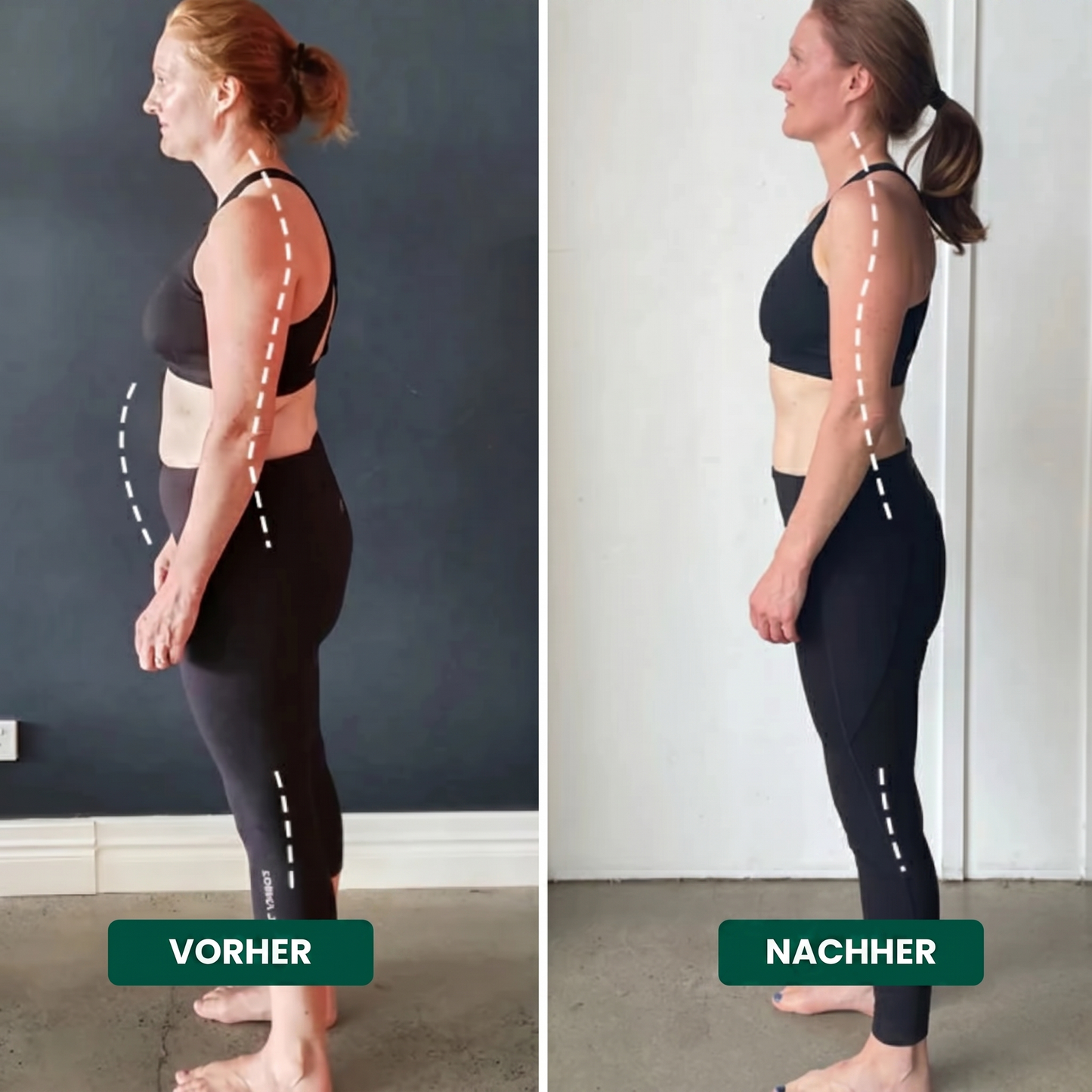 Frexova™ Gürtel – Lindert Rückenschmerzen und verbessert die Körperhaltung